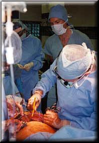 Dr. Cameron holding tumor flaps back with left hand and with right hand electrocauterizing tumor from the diaphgragm. R.Worthington observing.
